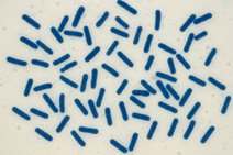 Skąd się biorą bakterie w mleku?